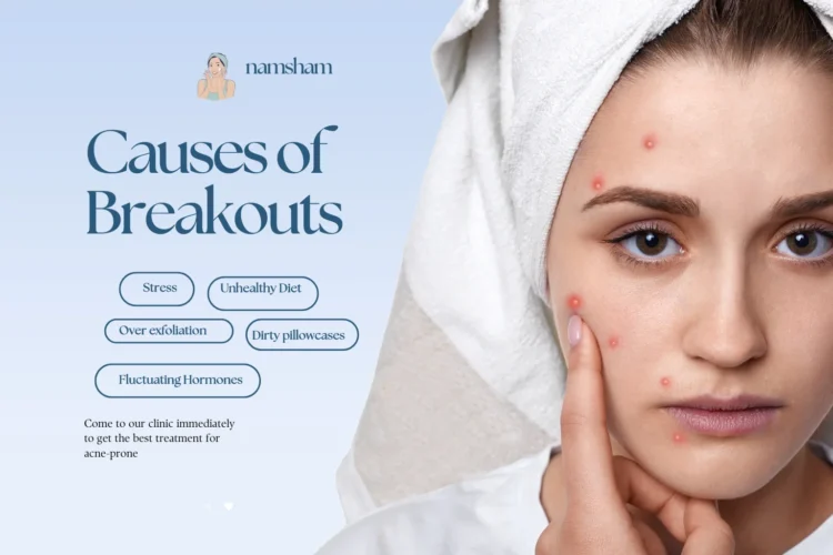 Woman cleansing her face as part of monsoon skin care routine to prevent acne