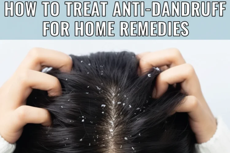 hair dandruff home remedies using aloe vera, coconut oil, tea tree oil, lemon, yogurt, and neem to treat dry scalp naturally